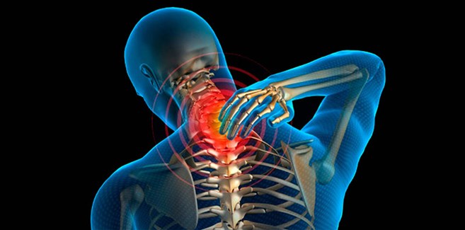 گردن‌درد عصبی چیست و چه راه‌هایی برای درمان آن وجود دارد؟